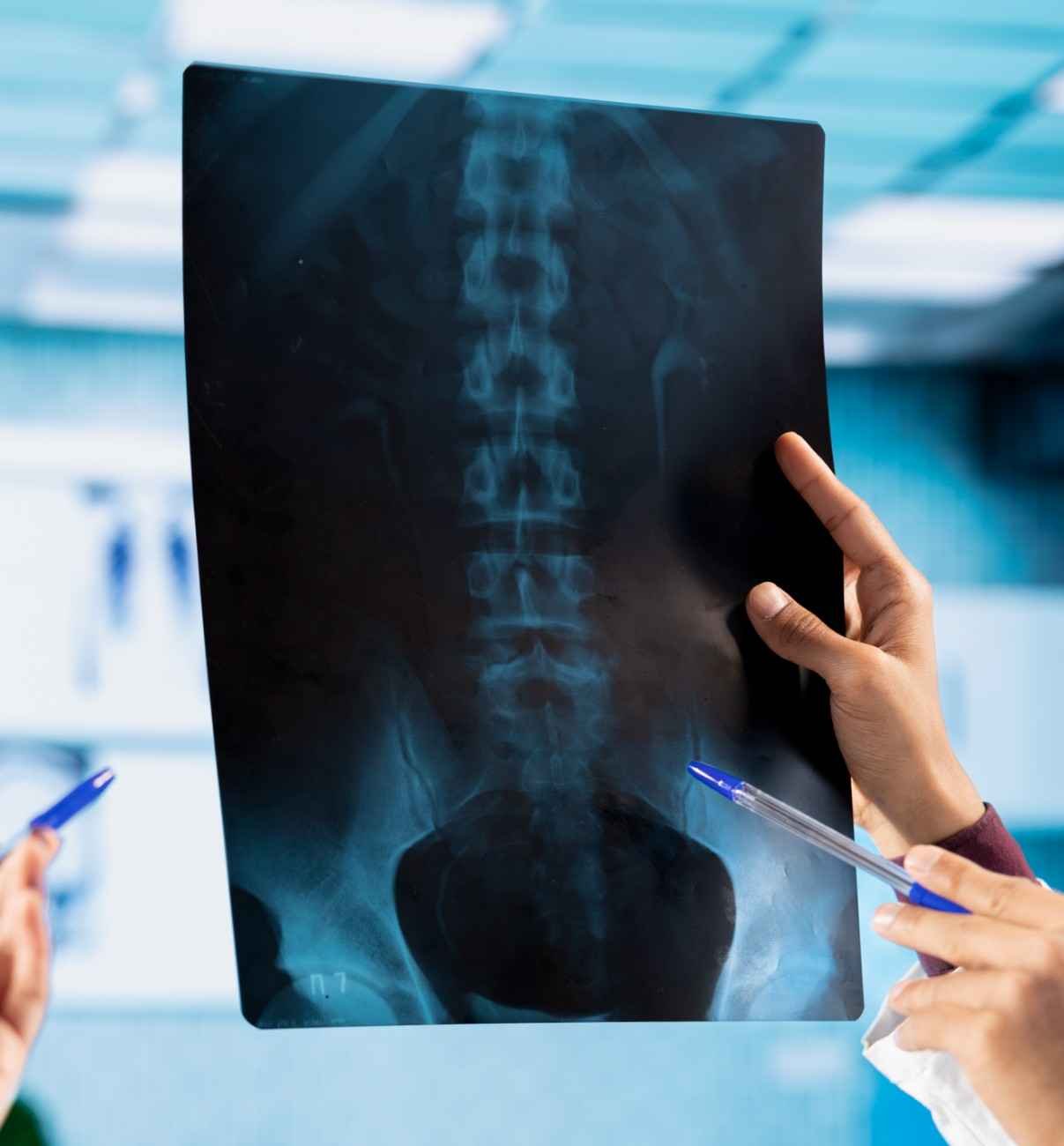 X-RAY